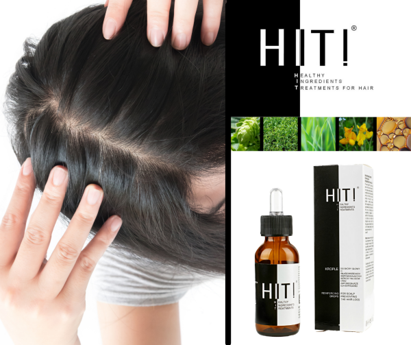 Wypadanie włosów po&nbsp;Covid 19 - coraz częściej jest to problem wielu ozdrowieńców.