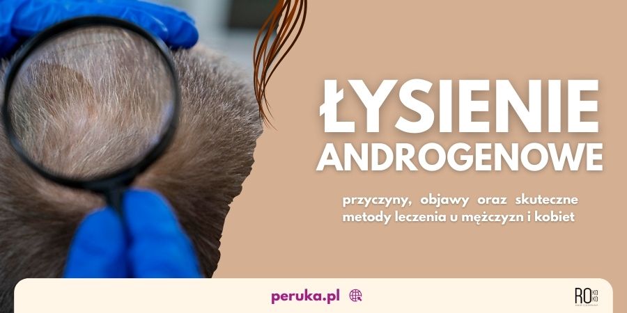 Łysienie androgenowe u kobiet i mężczyzn - przyczyny i leczenie